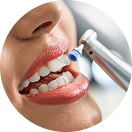Professionelle Zahnreinigung